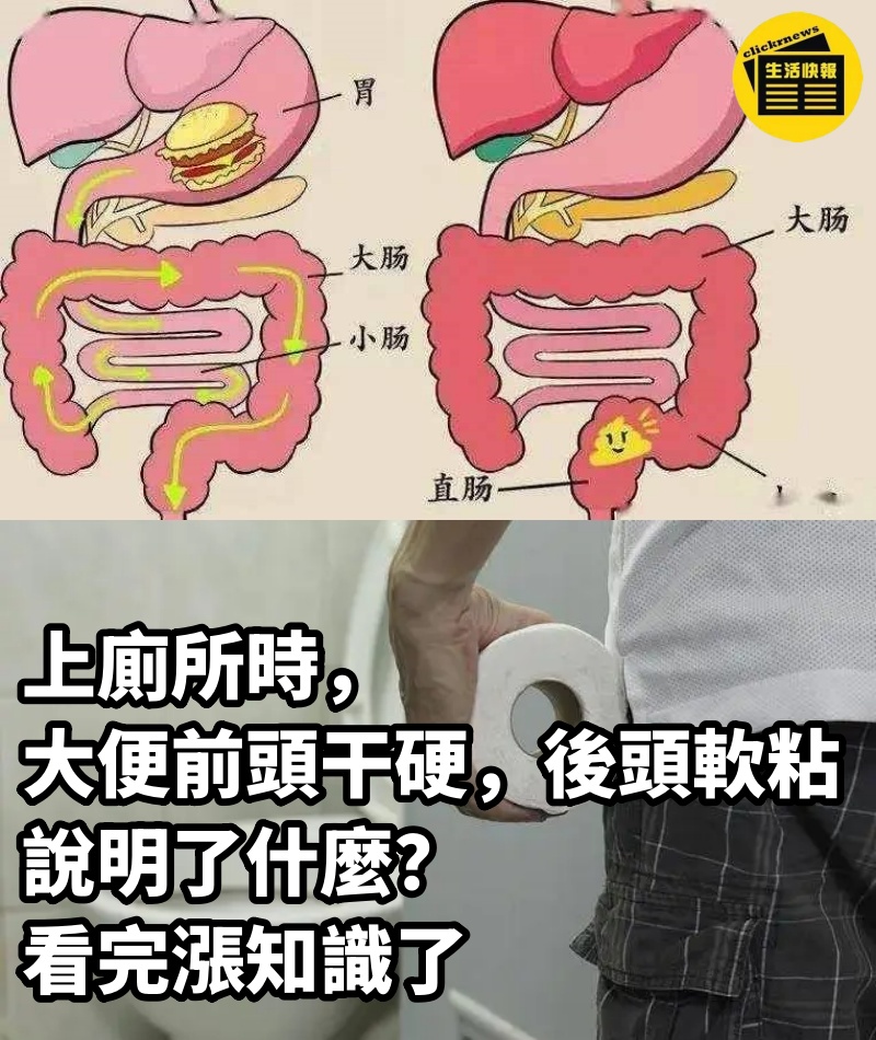 上廁所時，大便前頭干硬，後頭軟粘，說明了什麼？看完漲知識了