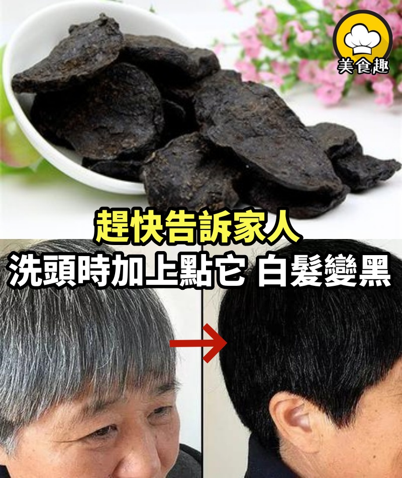 趕快告訴爺爺奶奶只需洗頭時加上點它，30天幫你頭髮變黑！