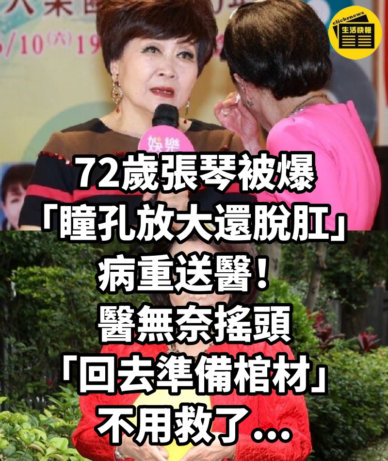 72歲張琴被爆「瞳孔放大還脫肛」病重送醫！醫無奈搖頭「回去準備棺材」：不用救了...