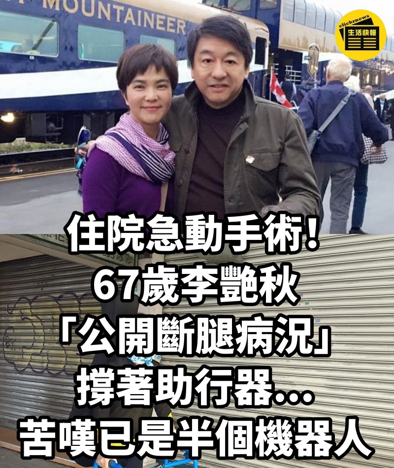 住院急動手術！67歲李艷秋「公開斷腿病況」撐著助行器...苦嘆已是半個機器人