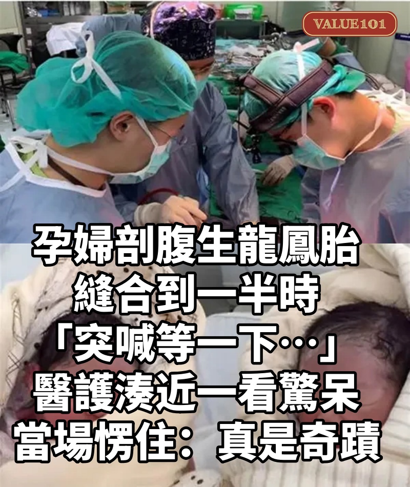 孕婦剖腹生龍鳳胎！縫合到一半時「突喊等一下…」醫護「湊近一看驚呆」當場愣住：真是奇蹟