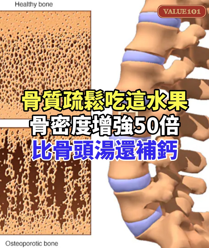 老了不想得骨質疏鬆，這水果每天早上吃1個，骨密度增強50倍，比骨頭湯還補鈣！到80歲走路還健步如飛！