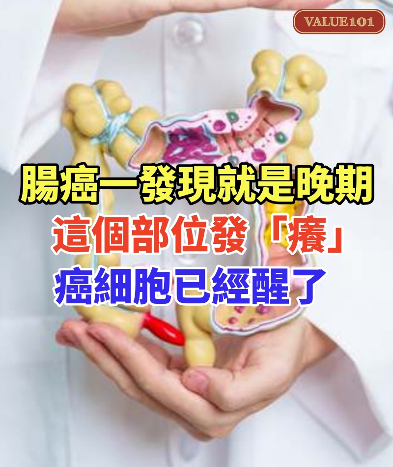 腸癌一發現就是晚期！一般身體這個部位發「癢」癌細胞已經醒了