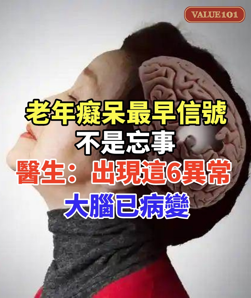 老年癡呆最早信號不是忘事！醫生：頻繁出現這6異常，大腦已病變