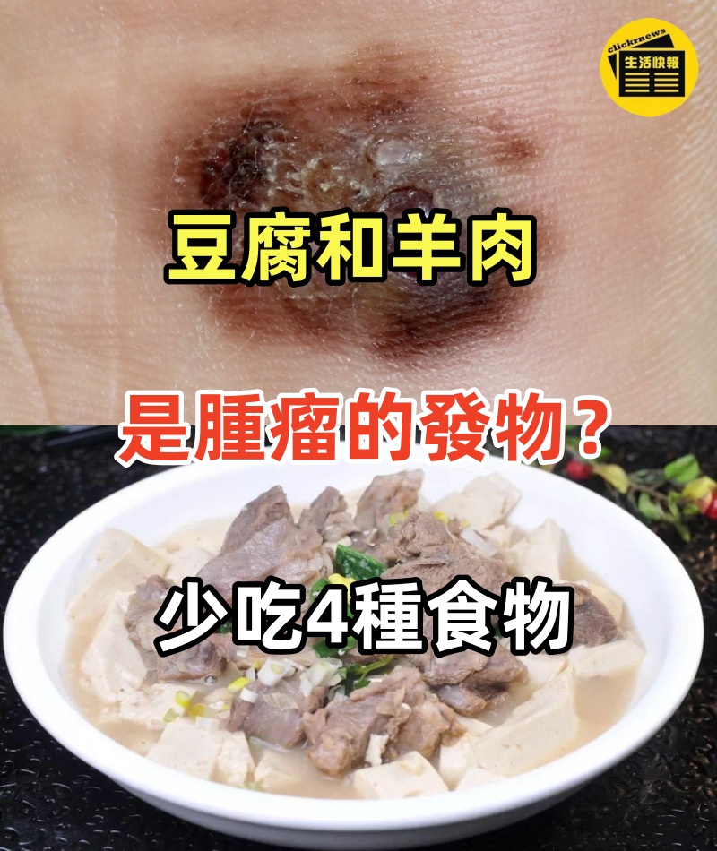 豆腐和羊肉是腫瘤的「發物」？錯！不想癌細胞惡化，少吃4種食物