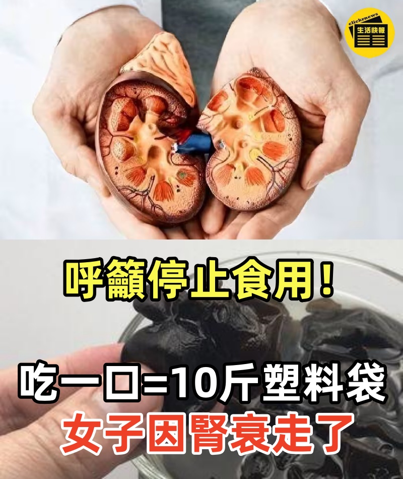 多名院士呼籲停止食用：吃一口等於10斤塑料袋，女子因腎衰走了