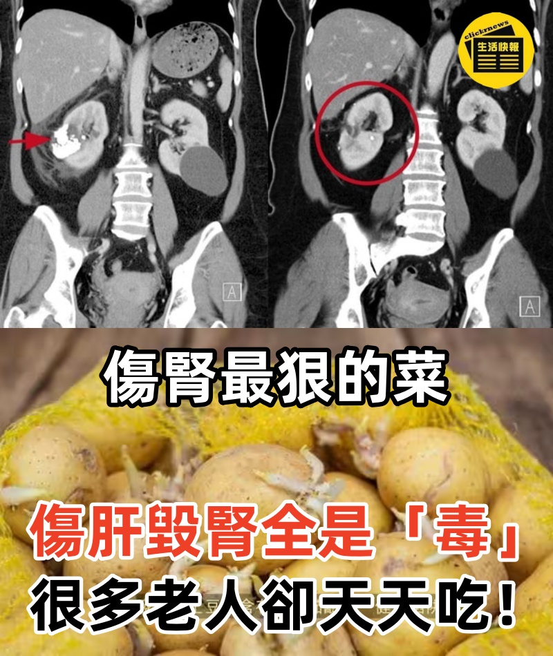 醫生警告：傷腎最狠的菜，傷肝毀腎全是「毒」，很多老人卻天天吃！等到腎衰竭就晚了！
