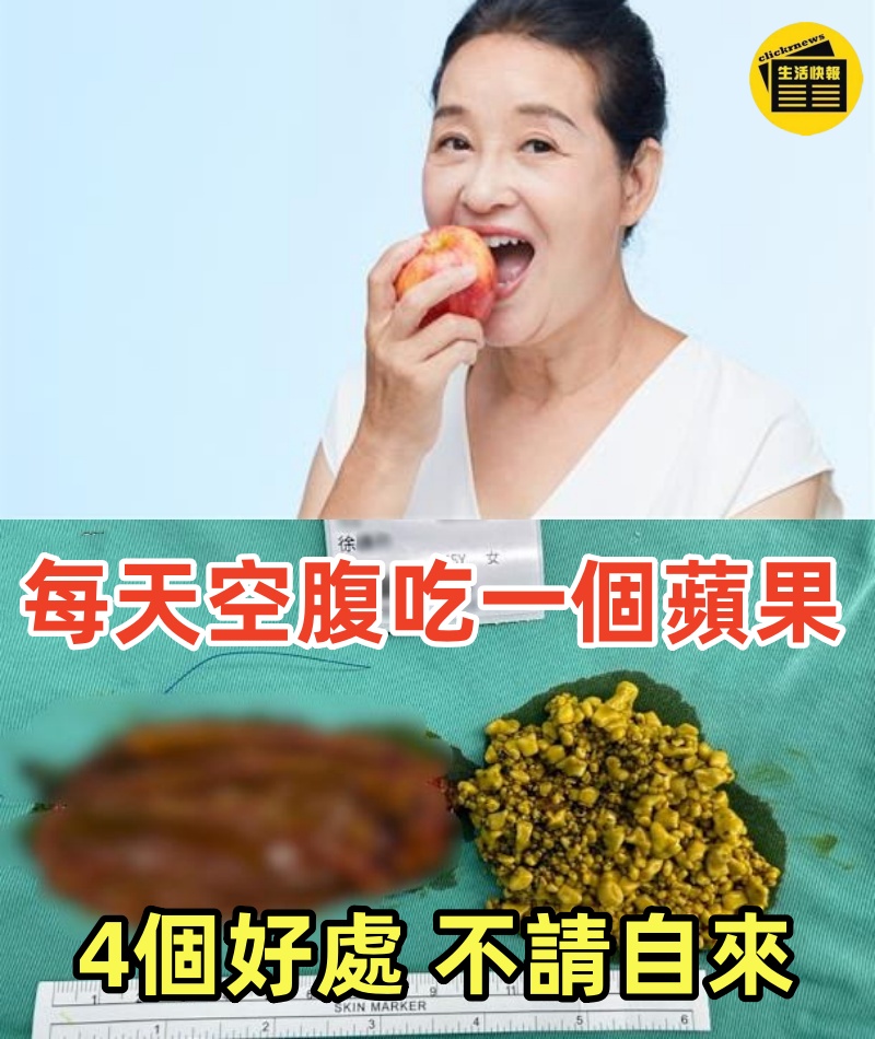 每天空腹吃一個蘋果，堅持半個月，「4個好處」不請自來