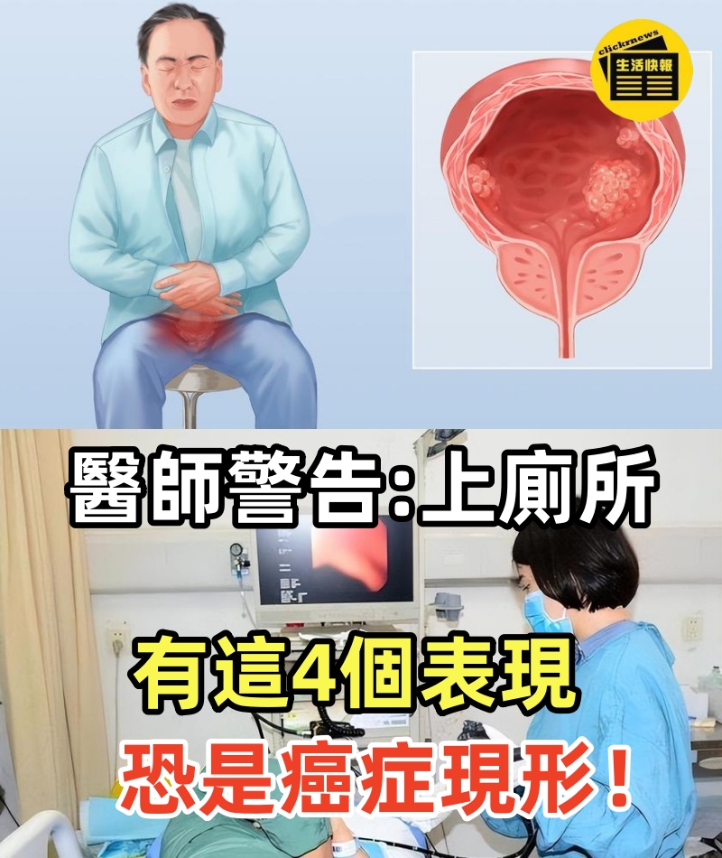 體內有癌，大小便先知！醫師鄭重警告： 上廁所有這4個表現，恐是「癌症現形」！再不理，神仙也難救！