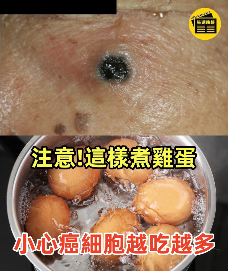 注意！早上這樣煮雞蛋，小心癌細胞越吃越多 不想一過40歲就被癌症纏上的，建議你花2分鍾看看