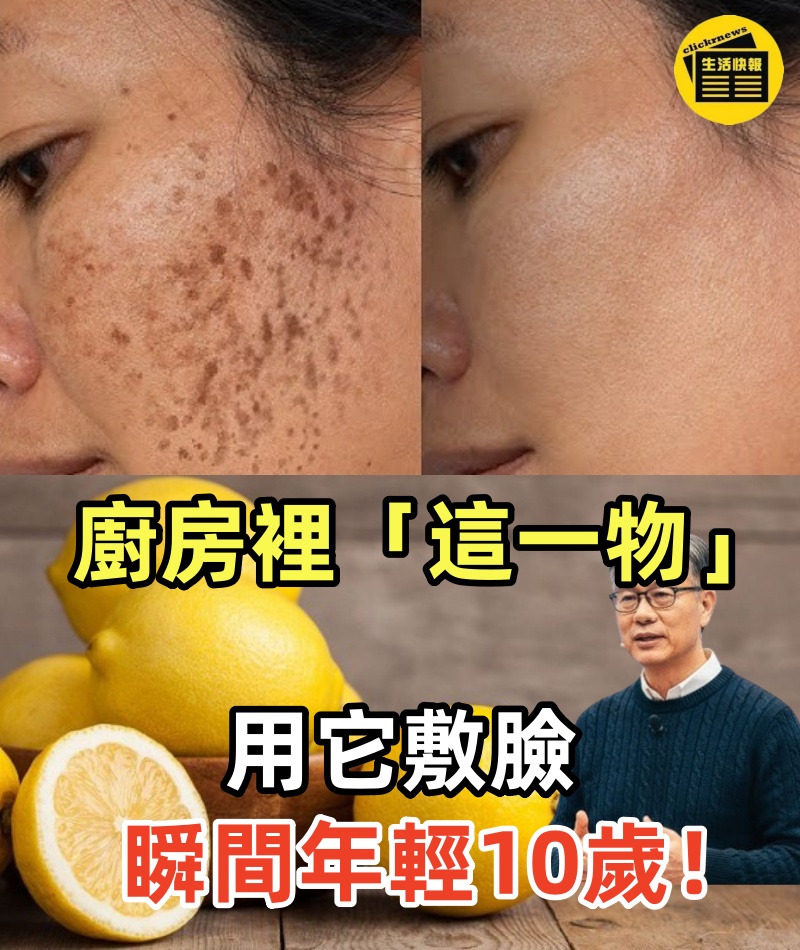 廚房裡「這一物」是消除老人斑的靈丹妙藥！用它敷臉，黑斑和老人斑徹底消失！瞬間年輕10歲！