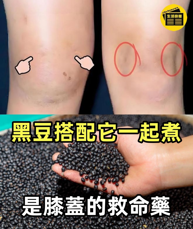 黑豆搭配它一起煮，是膝蓋的救命藥，只喝一次，可快速消除關節積液、消炎止痛，從此告別膝蓋關節疼痛，遠離滑膜炎