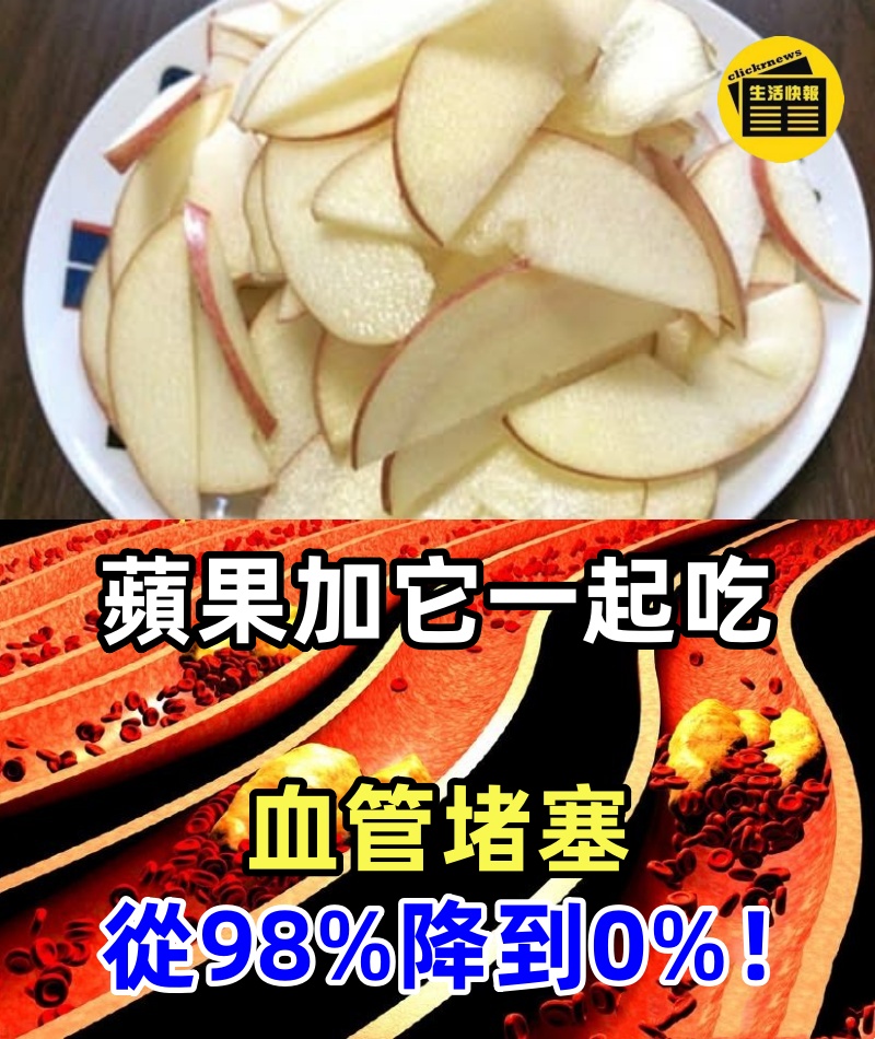 75歲堵住3根血管，蘋果加它一起吃，血管堵塞從98%降到0%！血栓斑塊不見了，血壓也降了，比每天走2小時還有效