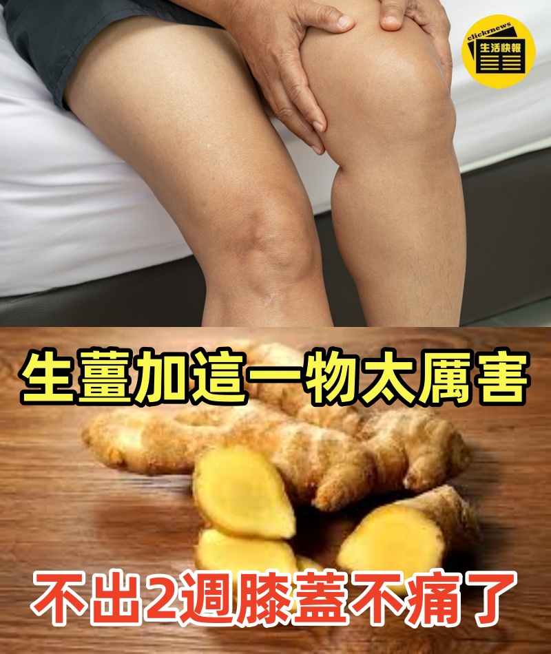 生薑加這一物太厲害了！不出2週，膝蓋不痛了，滑膜炎積水也緩解了