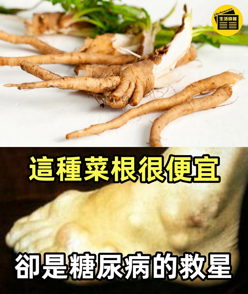 這種菜根很便宜，卻是糖尿病的救星，喝一次就讓你的血糖立馬恢復到正常值，平常喝還能預防糖尿病
