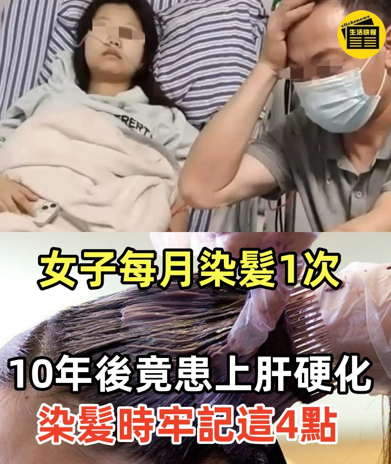 女子每月染髮1次，10年後竟患上肝硬化!!! 提醒：染髮時，牢記這4點