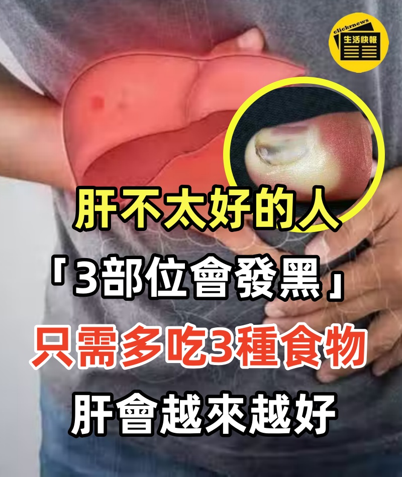 中醫師坦白：肝不太好的人「3部位會發黑」 只需「多吃3種食物」肝會越來越好~