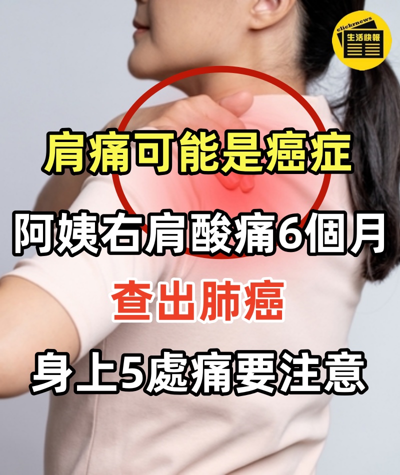 肩痛可能是癌症！阿姨「右肩酸痛6個月」查出肺癌　「身上5處會痛」要注意了!