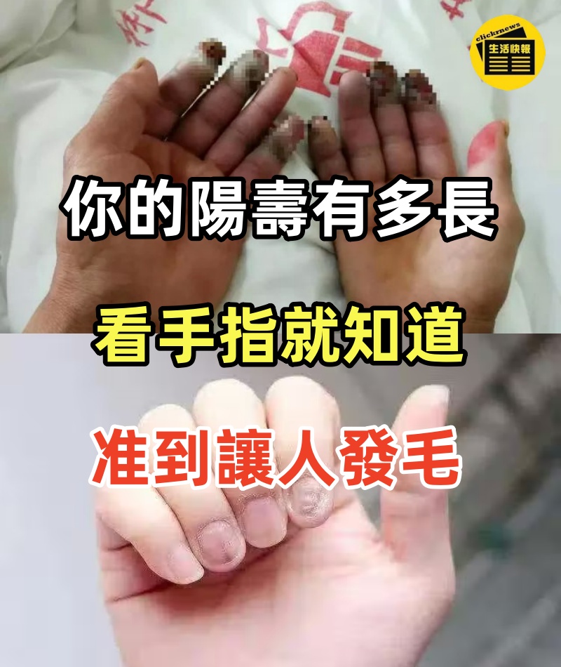 你的陽壽有多長，看手指就知道了，准到讓人發毛