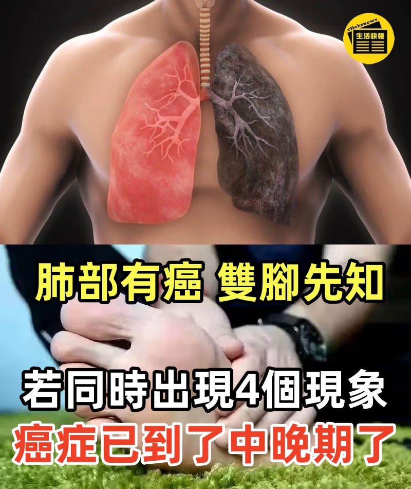 肺部有癌，雙腳先知？若同時出現4個現象， 或癌症已經到了中晚期了，不可不知哦!