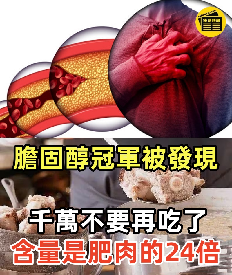 「膽固醇冠軍」被發現！千萬不要再吃了，含量是肥肉的24倍， 很多人天天在吃