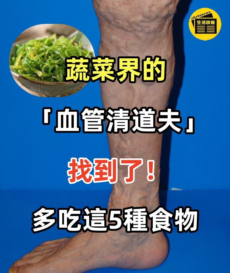 蔬菜界的「血管清道夫」找到了！若你愛吃這5種食物　血管會很感激你！