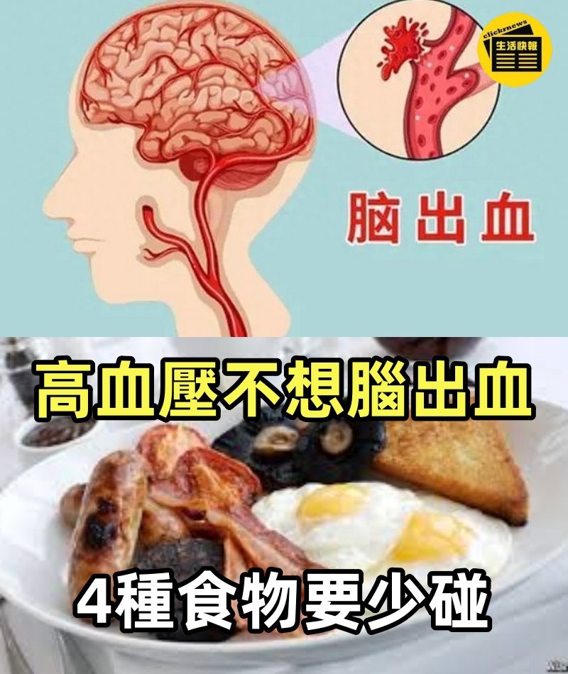再三提醒：高血壓不想腦出血，4種食物要少碰，再饞也要忍住