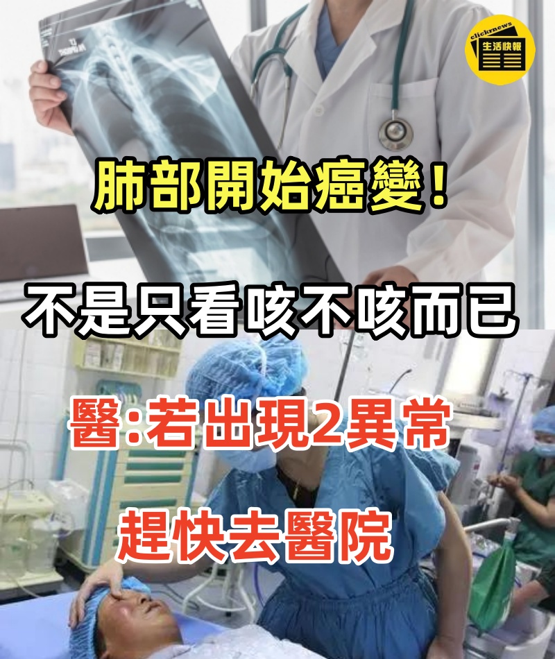 肺部開始癌變！不是只看「咳不咳」而已，醫生告誡「若出現2異常」：趕快去醫院