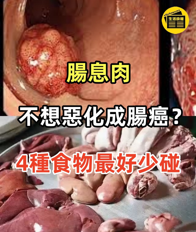 腸息肉不想惡化成腸癌？！這4種食物最好少碰，再愛吃也要忍